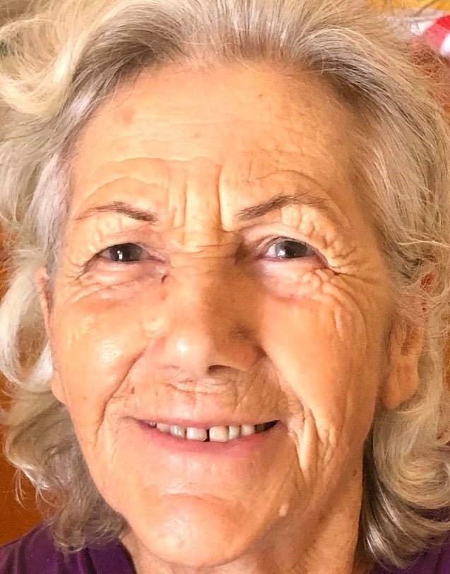 gallbladderliver Koureli Eleytheria later