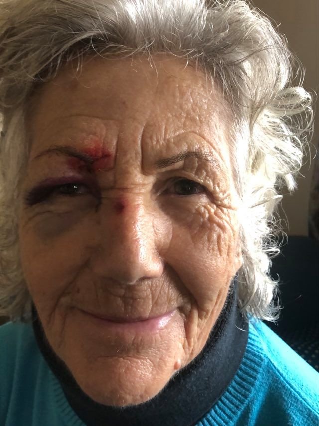 gallbladderliver Koureli Eleytheria next day