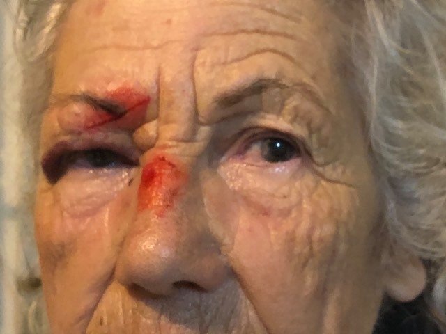 gallbladderliver Koureli Eleytheria