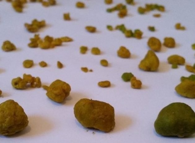 gallbladderliver Chronology Gallstones2