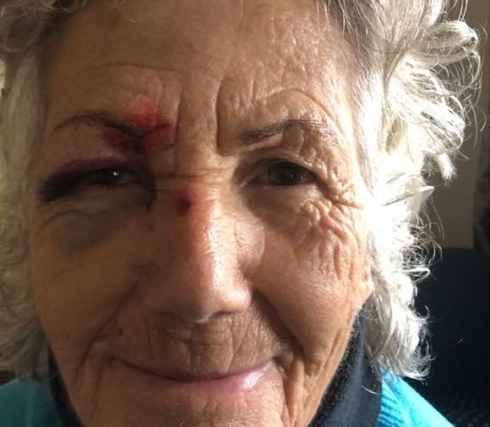 gallbladderliver Koureli Eleytheria next day